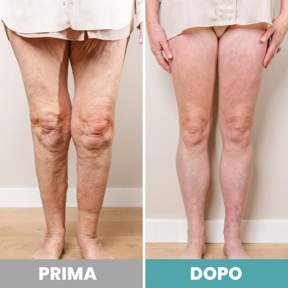 FormRelief EMS™ – Massaggiatore Plantare Intelligente a Impulsi